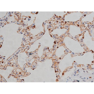 LYN Antibody - 1:200 staining rat lung tissue by IHC-P. The tissue was formaldehyde fixed and a heat mediated antigen retrieval step in citrate buffer was performed. The tissue was then blocked and incubated with the antibody for 1.5 hours at 22°C. An HRP conjugated goat anti-rabbit antibody was used as the secondary.