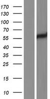 LYN Protein - Western validation with an anti-DDK antibody * L: Control HEK293 lysate R: Over-expression lysate