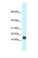 LYNX1 Antibody - LYNX1 antibody Western blot of Mouse Heart lysate. Antibody concentration 1 ug/ml.  This image was taken for the unconjugated form of this product. Other forms have not been tested.