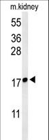 LYPD1 Antibody - Western blot of LYPD1 Antibody in mouse kidney tissue lysates (35 ug/lane). LYPD1 (arrow) was detected using the purified antibody.