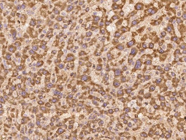 LYPD2 Antibody - Immunochemical staining of human LYPD2 in human liver with rabbit polyclonal antibody at 1:100 dilution, formalin-fixed paraffin embedded sections.