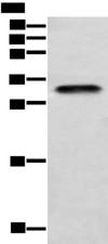 LYPD4 Antibody - Western blot analysis of Human testis tissue  using LYPD4 Polyclonal Antibody at dilution of 1:400