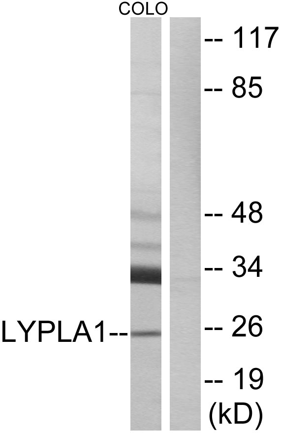 LYPLA1 Antibody - Western blot analysis of lysates from COLO cells, using LYPLA1 Antibody. The lane on the right is blocked with the synthesized peptide.