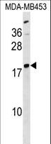 LYPLA1 Antibody - LYPLA1 Antibody western blot of MDA-MB453 cell line lysates (35 ug/lane). The LYPLA1 antibody detected the LYPLA1 protein (arrow).