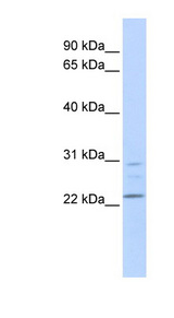 LYPLA1 Antibody - LYPLA1 antibody Western blot of CCRF-CEM lysate. This image was taken for the unconjugated form of this product. Other forms have not been tested.
