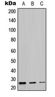 LYPLA1 Antibody - Western blot analysis of LYPLA1 expression in MDAMB453 (A); mouse kidney (B); rat kidney (C) whole cell lysates.