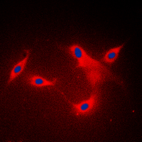 LYPLA1 Antibody - Immunofluorescent analysis of LYPLA1 staining in MDAMB453 cells. Formalin-fixed cells were permeabilized with 0.1% Triton X-100 in TBS for 5-10 minutes and blocked with 3% BSA-PBS for 30 minutes at room temperature. Cells were probed with the primary antibody in 3% BSA-PBS and incubated overnight at 4 C in a humidified chamber. Cells were washed with PBST and incubated with a DyLight 594-conjugated secondary antibody (red) in PBS at room temperature in the dark. DAPI was used to stain the cell nuclei (blue).