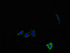 LYPLA1 Antibody - Immunofluorescent analysis of Hela cells using Lypla1 Antibody at dilution of 1:100 and Alexa Fluor 488-congugated AffiniPure Goat Anti-Rabbit IgG(H+L)