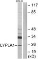 LYPLA1 Antibody - Western blot analysis of extracts from COLO cells, using LYPLA1 antibody.