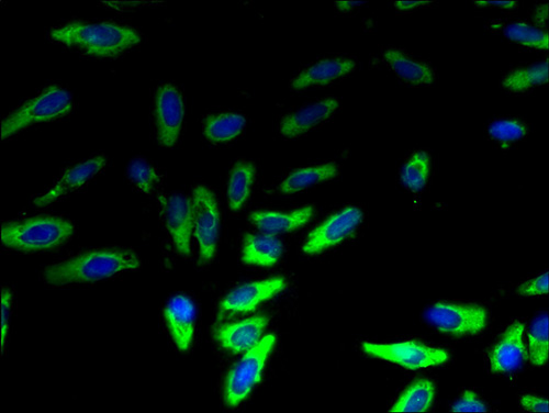 LYPLA2 Antibody - Immunofluorescent analysis of Hela cells using Anti-LYPLA2 Antibody at a dilution of 1:100 and Alexa Fluor 488-congugated AffiniPure Goat Anti-Rabbit IgG(H+L)..  This image was taken for the unconjugated form of this product. Other forms have not been tested.