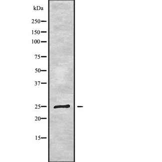 LYPLA2 Antibody - Western blot analysis of LYPLA2 using COLO205 whole cells lysates
