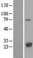 LYPLA2 Protein - Western validation with an anti-DDK antibody * L: Control HEK293 lysate R: Over-expression lysate