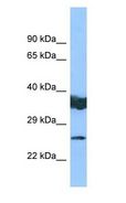 LYPLAL1 Antibody - LYPLAL1 antibody Western Blot of COLO205.  This image was taken for the unconjugated form of this product. Other forms have not been tested.