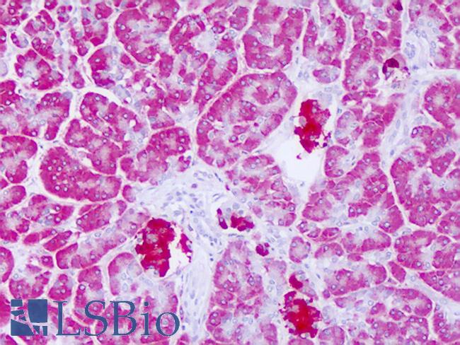 LYPLAL1 Antibody - Anti-LYPLAL1 antibody IHC of human pancreas. Immunohistochemistry of formalin-fixed, paraffin-embedded tissue after heat-induced antigen retrieval. Antibody dilution 5-10 ug/ml. This image was taken for the unconjugated form of this product. Other forms have not been tested.