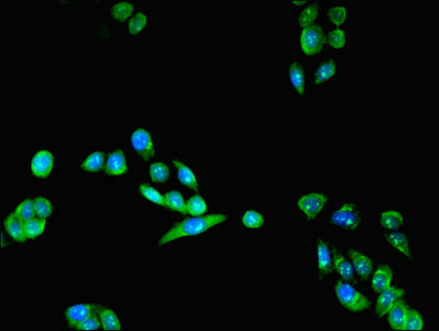 LYPLAL1 Antibody - Immunofluorescent analysis of PC-3 cells using LYPLAL1 Antibody at dilution of 1:100 and Alexa Fluor 488-congugated AffiniPure Goat Anti-Rabbit IgG(H+L)
