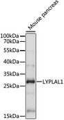 LYPLAL1 Antibody - Western blot analysis of extracts of Mouse pancreas, using LYPLAL1 antibody at 1:1000 dilution. The secondary antibody used was an HRP Goat Anti-Rabbit IgG (H+L) at 1:10000 dilution. Lysates were loaded 25ug per lane and 3% nonfat dry milk in TBST was used for blocking. An ECL Kit was used for detection and the exposure time was 30s.