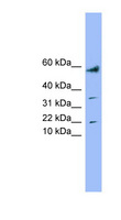LYRM1 Antibody - LYRM1 antibody Western blot of Placenta lysate. This image was taken for the unconjugated form of this product. Other forms have not been tested.