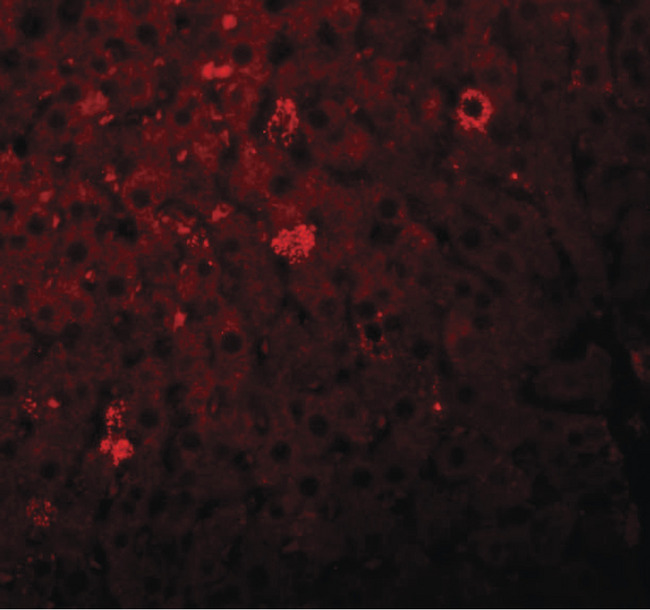 LYRM1 Antibody - Immunofluorescence of LYRM1 in rat liver tissue with LYRM1 antibody at 20 ug/ml.