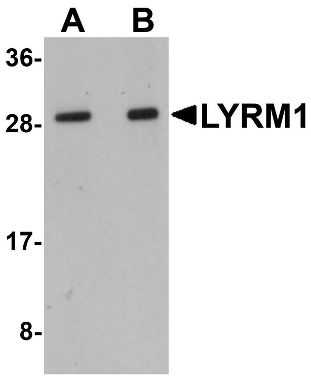 LYRM1 Antibody - Western blot analysis of LYRM1 in human liver tissue lysate with LYRM1 antibody at (A) 1 and (B) 2 ug/ml.