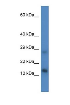 LYRM4 Antibody - LYRM4 antibody Western blot of Mouse Liver lysate. Antibody concentration 1 ug/ml. This image was taken for the unconjugated form of this product. Other forms have not been tested.