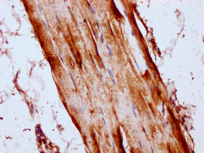 LYRM4 Antibody - Immunohistochemistry Dilution at 1:300 and staining in paraffin-embedded human skeletal muscle tissue performed on a Leica BondTM system. After dewaxing and hydration, antigen retrieval was mediated by high pressure in a citrate buffer (pH 6.0). Section was blocked with 10% normal Goat serum 30min at RT. Then primary antibody (1% BSA) was incubated at 4°C overnight. The primary is detected by a biotinylated Secondary antibody and visualized using an HRP conjugated SP system.