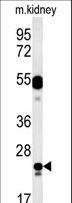 LYSMD1 Antibody - LYSMD1 Antibody western blot of mouse kidney tissue lysates (15 ug/lane). The LYSMD1 antibody detected LYSMD1 protein (arrow).