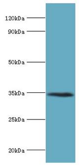 LYVE1 Antibody - Western blot. All lanes: Lymphatic vessel endothelial hyaluronic acid receptor 1 antibody at 8 ug/ml+mouse liver tissue. Secondary antibody: Goat polyclonal to rabbit at 1:10000 dilution. Predicted band size: 35 kDa. Observed band size: 35 kDa Immunohistochemistry.