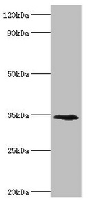 LYVE1 Antibody - Western blot All lanes: Lymphatic vessel endothelial hyaluronic acid receptor 1 antibody at 8µg/ml + Mouse liver tissue Secondary Goat polyclonal to rabbit IgG at 1/10000 dilution Predicted band size: 35 kDa Observed band size: 35 kDa