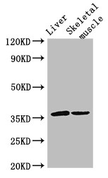 LYVE1 Antibody - Positive WB detected in:Mouse liver tissue,Mouse skeletal muscle tissue;All lanes:LYVE1 antibody at 3?g/ml;Secondary;Goat polyclonal to rabbit IgG at 1/50000 dilution;Predicted band size: 36 KDa;Observed band size: 36 KDa;