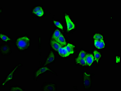 LYVE1 Antibody - Immunofluorescence staining of MCF-7 cells with LYVE1 Antibody at 1:200, counter-stained with DAPI. The cells were fixed in 4% formaldehyde, permeabilized using 0.2% Triton X-100 and blocked in 10% normal Goat Serum. The cells were then incubated with the antibody overnight at 4°C. The secondary antibody was Alexa Fluor 488-congugated AffiniPure Goat Anti-Rabbit IgG(H+L).