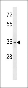 LYVE1 Antibody - XLKD1 Antibody western blot of HL-60 cell line lysates (35 ug/lane). The XLKD1 antibody detected the XLKD1 protein (arrow).