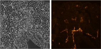 LYVE1 Antibody - Immunohistochemistry of cryosections of mouse intestine at 2.5 ug/ml of anti-mouse LYVE-1 antibody followed by Rhodamine anti-rat IgG (right). Phase image of same field (left).