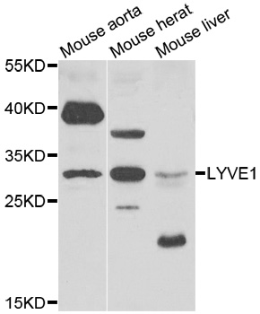 LYVE1 Antibody - Western blot analysis of extracts of various cell lines.