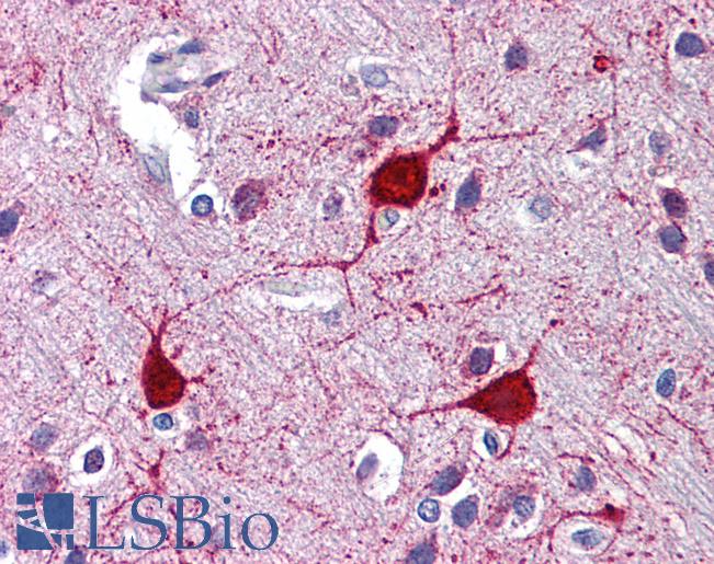 LYVE1 Antibody - Anti-LYVE1 / LYVE-1 antibody IHC of human brain, cortex. Immunohistochemistry of formalin-fixed, paraffin-embedded tissue after heat-induced antigen retrieval. Antibody concentration 5 ug/ml.  This image was taken for the unconjugated form of this product. Other forms have not been tested.