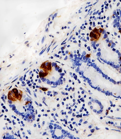 LYZ / Lysozyme Antibody - Immunohistochemical of paraffin-embedded H. small intestine section using LYZ Antibody. Antibody was diluted at 1:100 dilution. A peroxidase-conjugated goat anti-rabbit IgG at 1:400 dilution was used as the secondary antibody, followed by DAB staining.