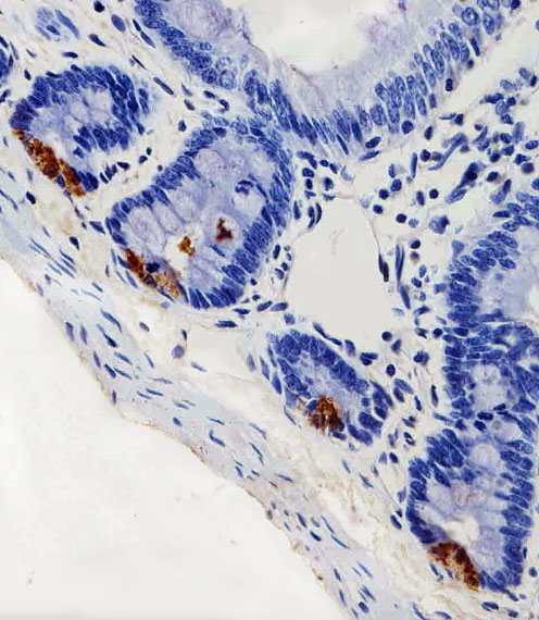 LYZ / Lysozyme Antibody - Immunohistochemical of paraffin-embedded R. small intestine section using LYZ Antibody. Antibody was diluted at 1:100 dilution. A peroxidase-conjugated goat anti-rabbit IgG at 1:400 dilution was used as the secondary antibody, followed by DAB staining.