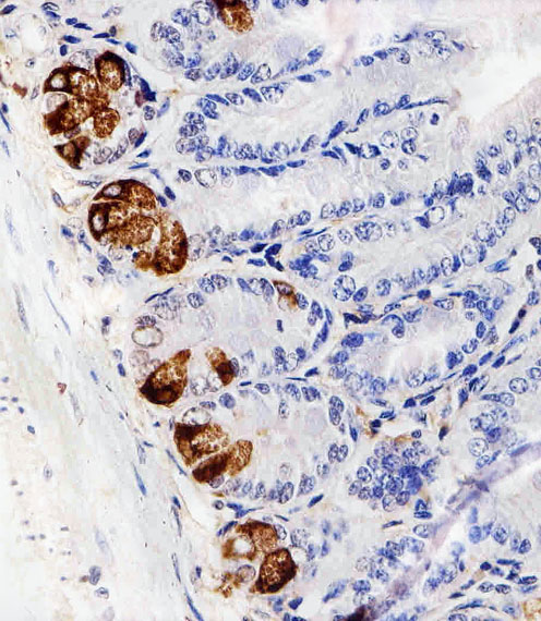 LYZ / Lysozyme Antibody - Immunohistochemical of paraffin-embedded M. small intestine section using LYZ Antibody. Antibody was diluted at 1:100 dilution. A peroxidase-conjugated goat anti-rabbit IgG at 1:400 dilution was used as the secondary antibody, followed by DAB staining.