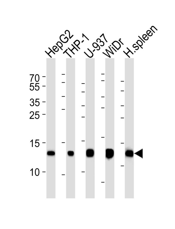 LYZ / Lysozyme Antibody - Western blot of lysates from HepG2, THP-1, U-937, WiDr cell line and human spleen (from left to right) with LYZ Antibody. Antibody was diluted at 1:1000 at each lane. A goat anti-rabbit IgG H&L (HRP) at 1:5000 dilution was used as the secondary antibody. Lysates at 35 ug per lane.