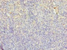 LYZ / Lysozyme Antibody - Immunohistochemistry of paraffin-embedded human tonsil using antibody at 1:100 dilution.  This image was taken for the unconjugated form of this product. Other forms have not been tested.
