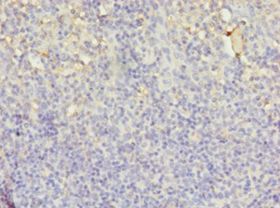 LYZ / Lysozyme Antibody - Immunohistochemistry of paraffin-embedded human tonsil using antibody at 1:100 dilution.  This image was taken for the unconjugated form of this product. Other forms have not been tested.