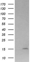 LYZ / Lysozyme Antibody - HEK293T cells were transfected with the pCMV6-ENTRY control (Left lane) or pCMV6-ENTRY LYZ (Right lane) cDNA for 48 hrs and lysed. Equivalent amounts of cell lysates (5 ug per lane) were separated by SDS-PAGE and immunoblotted with anti-LYZ.