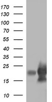 LYZ / Lysozyme Antibody - HEK293T cells were transfected with the pCMV6-ENTRY control (Left lane) or pCMV6-ENTRY LYZ (Right lane) cDNA for 48 hrs and lysed. Equivalent amounts of cell lysates (5 ug per lane) were separated by SDS-PAGE and immunoblotted with anti-LYZ.
