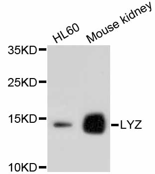LYZ / Lysozyme Antibody - Western blot analysis of extracts of various cell lines, using LYZ antibody. The secondary antibody used was an HRP Goat Anti-Rabbit IgG (H+L) at 1:10000 dilution. Lysates were loaded 25ug per lane and 3% nonfat dry milk in TBST was used for blocking.