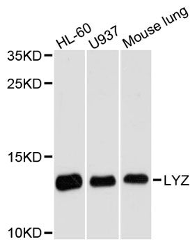 LYZ / Lysozyme Antibody - Western blot analysis of extracts of various cell lines, using LYZ antibody at 1:3000 dilution. The secondary antibody used was an HRP Goat Anti-Rabbit IgG (H+L) at 1:10000 dilution. Lysates were loaded 25ug per lane and 3% nonfat dry milk in TBST was used for blocking. An ECL Kit was used for detection and the exposure time was 90s.