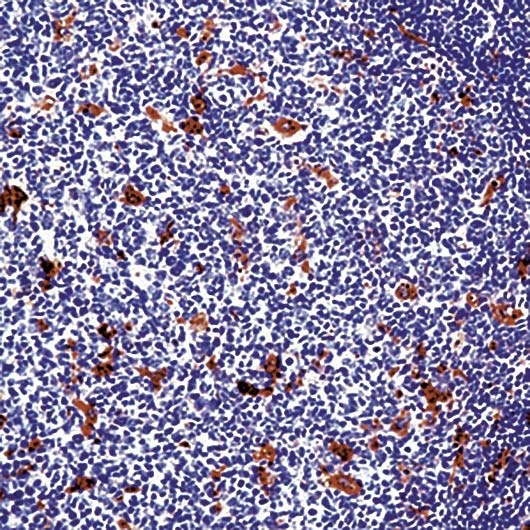 LYZ / Lysozyme Antibody - Formalin-fixed, paraffin-embedded human tonsil stained with Lysozyme antibody.
