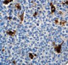 LYZ / Lysozyme Antibody - IHC of Lysozyme on FFPE Tonsil Tissue. This image was taken for the unmodified form of this product. Other forms have not been tested.