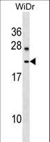 LYZL6 Antibody - LYZL6 Antibody western blot of WiDr cell line lysates (35 ug/lane). The LYZL6 antibody detected the LYZL6 protein (arrow).