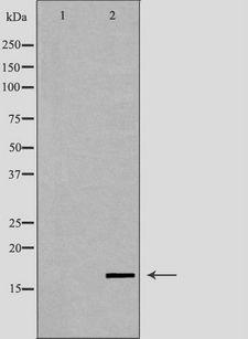 LYZL6 Antibody - Western blot analysis of human testis lysate using LYZL6 antibody. The lane on the left is treated with the antigen-specific peptide.