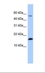 LYZL6 Antibody - Fetal lung lysate. Antibody concentration: 1.0 ug/ml. Gel concentration: 10-20%.  This image was taken for the unconjugated form of this product. Other forms have not been tested.
