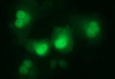 LZIC Antibody - Anti-LZIC mouse monoclonal antibody immunofluorescent staining of COS7 cells transiently transfected by pCMV6-ENTRY LZIC.
